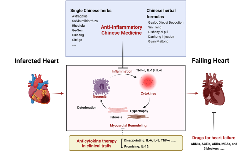 A schematic diagram of anti-inflammatory therapies and existing approved drugs for the treatment of heart failure