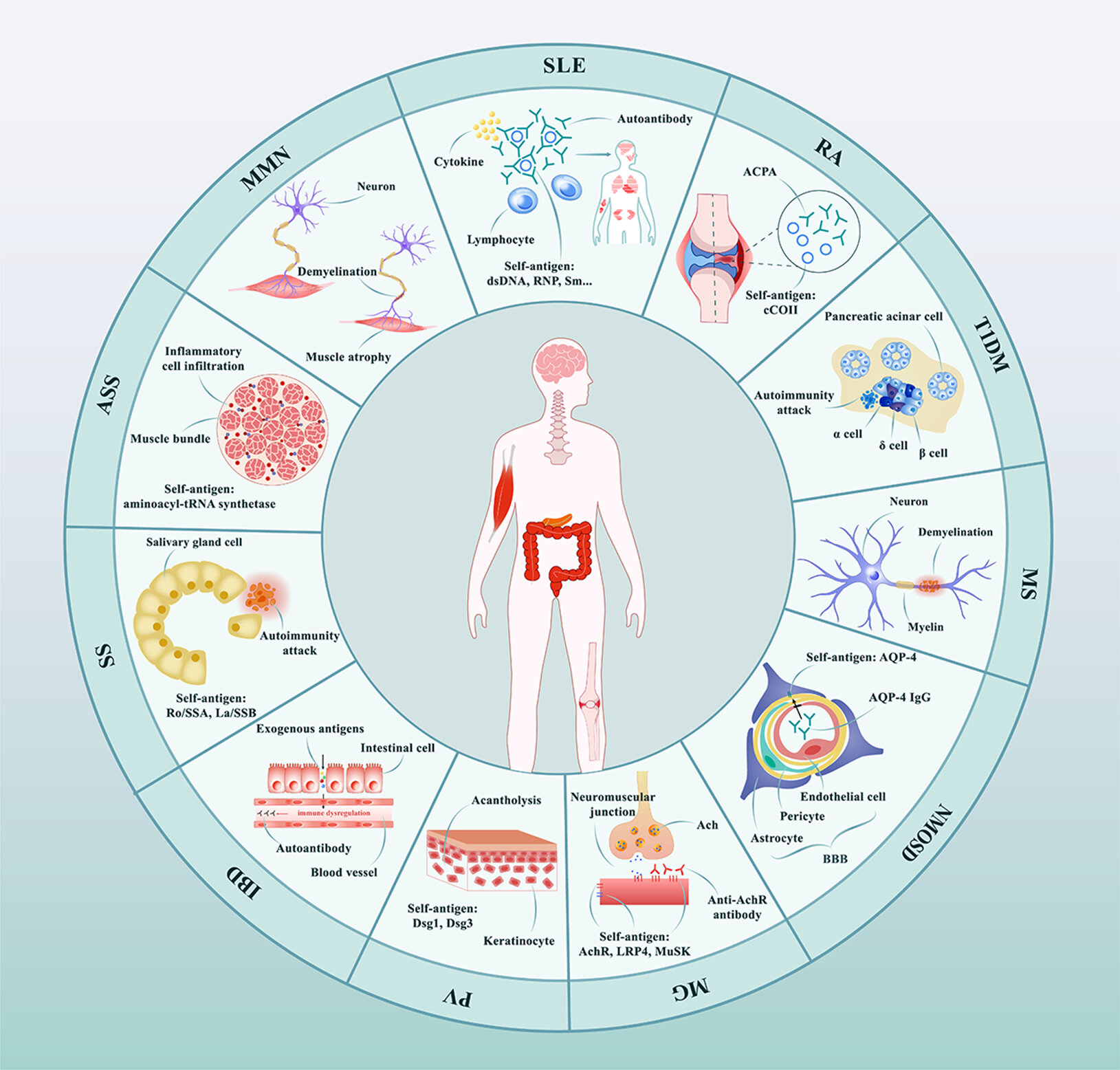 CAR-T cells can target autoreactive immune cells by using specific recognizing antibodies like CD19 (transmembrane glycoprotein of B cells) and BCMA (B-cell maturation antigen) and provide sustained treatment response in autoimmune disease.