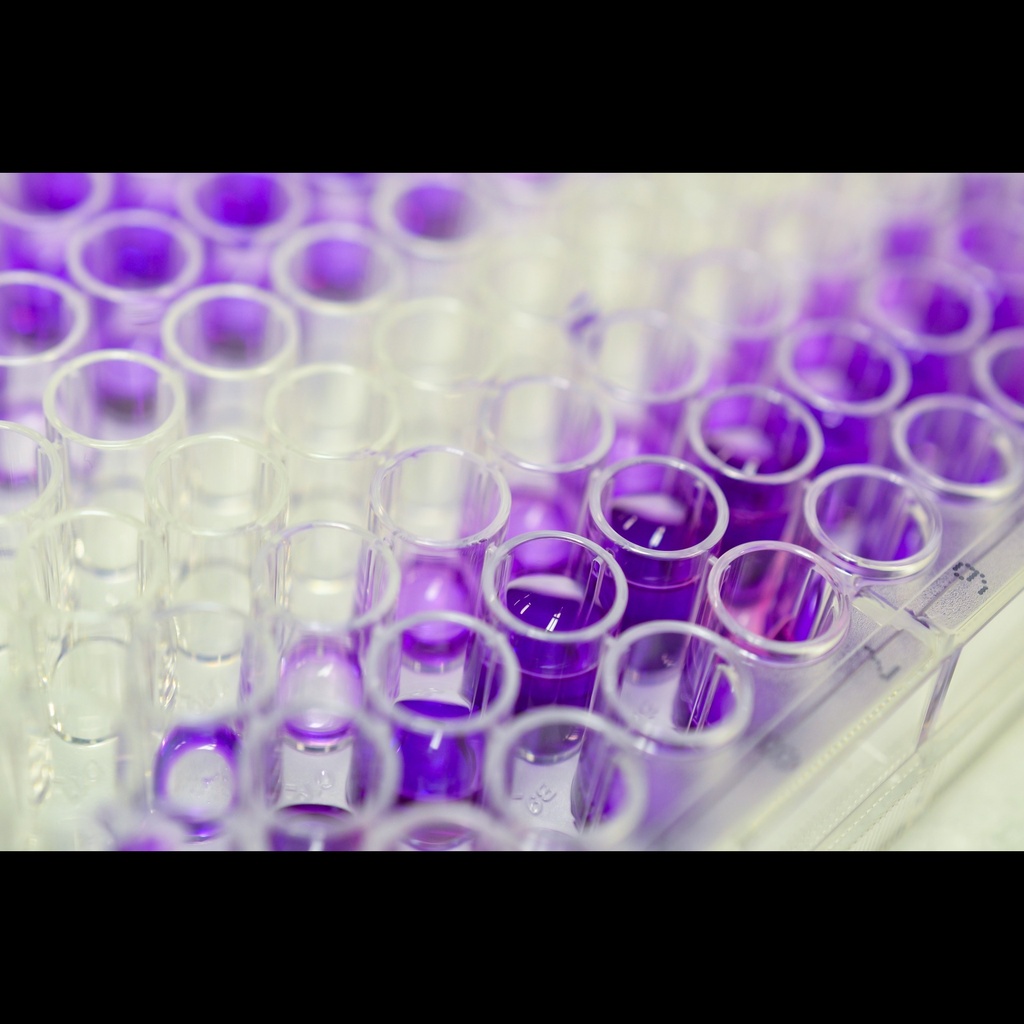 Mouse Serum Amyloid P ''SAP'' ELISA Assay   96 wells plate